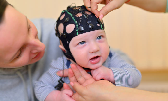 Диагностика детской эпилепсии с помощью видео ЭЭГ сна ребенка